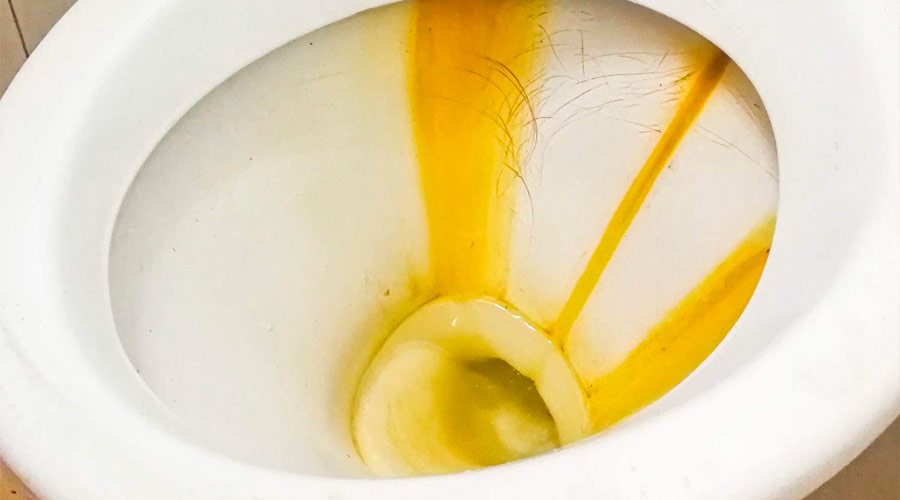 Macchie gialle di ruggine nel wc